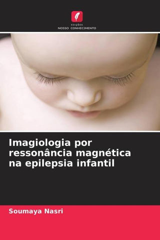 Imagiologia por ressonância magnética na epilepsia infantil