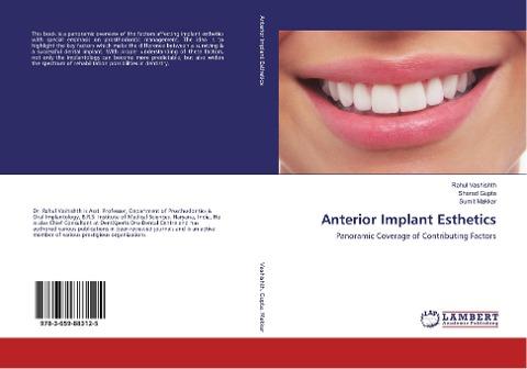 Anterior Implant Esthetics