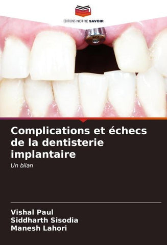 Complications et échecs de la dentisterie implantaire