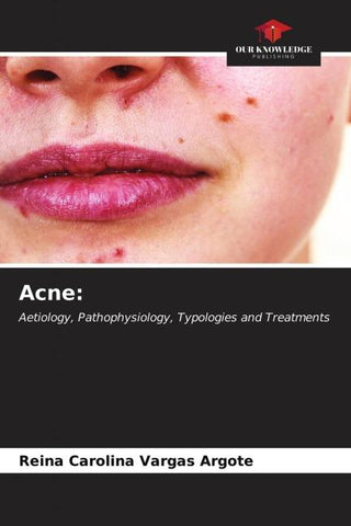 Acne: