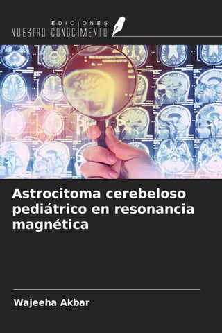 Astrocitoma cerebeloso pediátrico en resonancia magnética