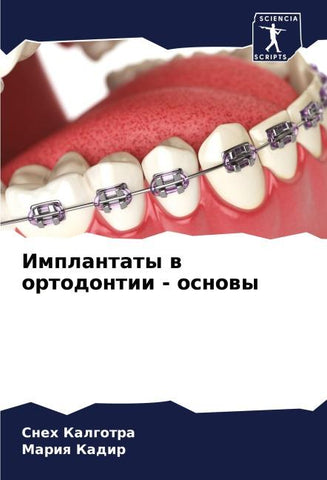 Implantaty w ortodontii - osnowy