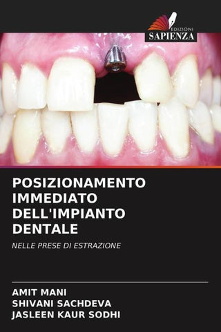 POSIZIONAMENTO IMMEDIATO DELL'IMPIANTO DENTALE