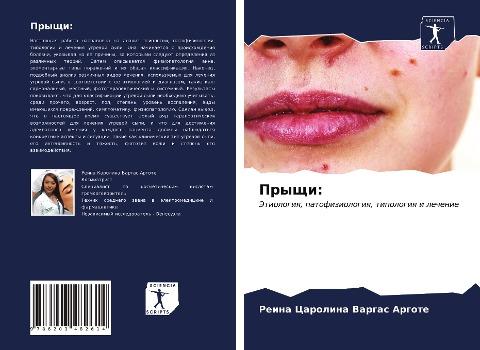 Pryschi: