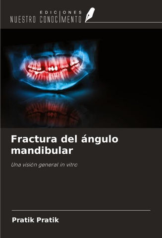 Fractura del ángulo mandibular