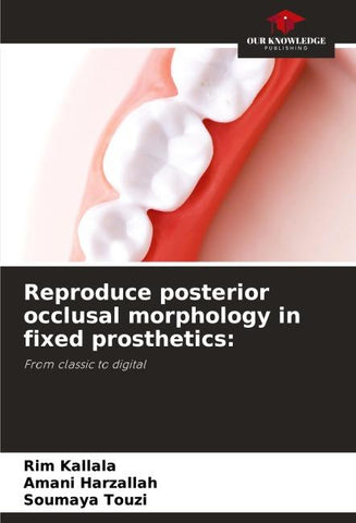 Reproduce posterior occlusal morphology in fixed prosthetics:
