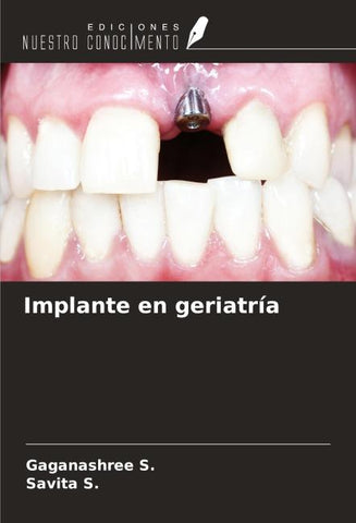Implante en geriatría