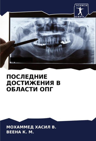POSLEDNIE DOSTIZhENIYa V OBLASTI OPG