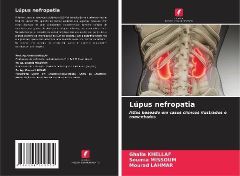 Lúpus nefropatia