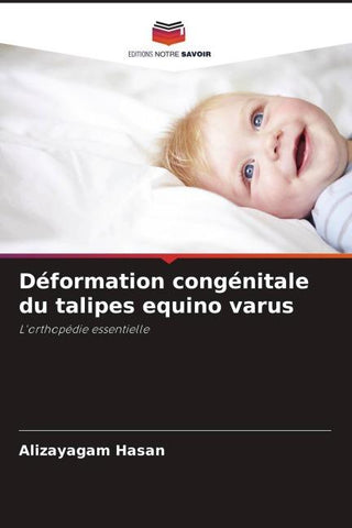 Déformation congénitale du talipes equino varus
