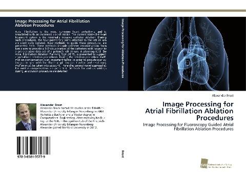 Image Processing for Atrial Fibrillation Ablation Procedures