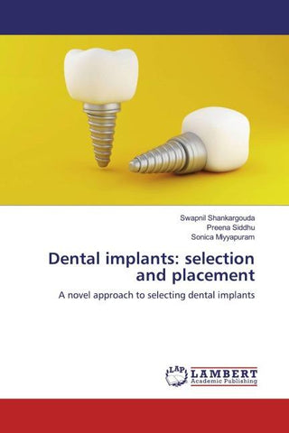 Dental implants: selection and placement