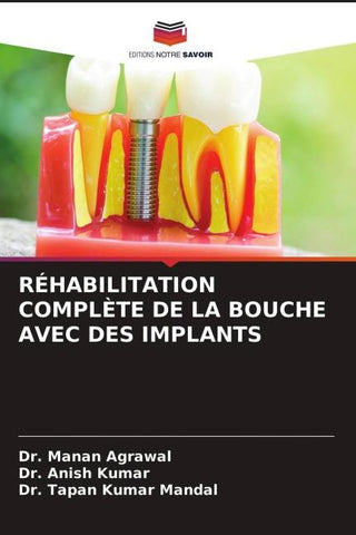 RÉHABILITATION COMPLÈTE DE LA BOUCHE AVEC DES IMPLANTS