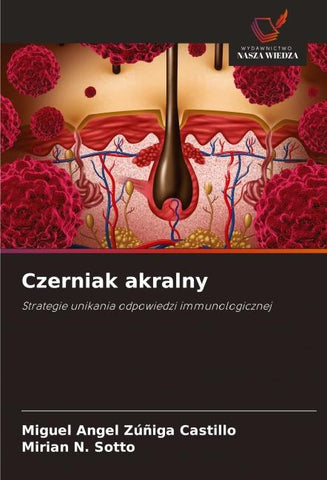 Czerniak akralny