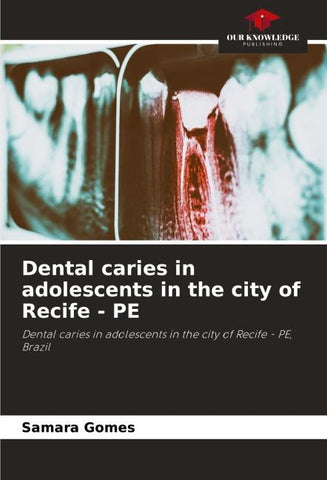Dental caries in adolescents in the city of Recife - PE