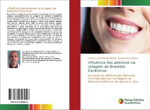 Influência dos adesivos na colagem de Brackets Cerâmicos