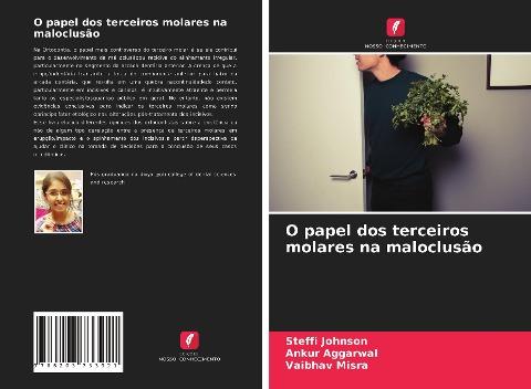 O papel dos terceiros molares na maloclusão