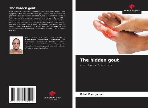 The hidden gout