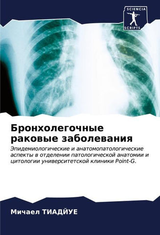 Bronholegochnye rakowye zabolewaniq