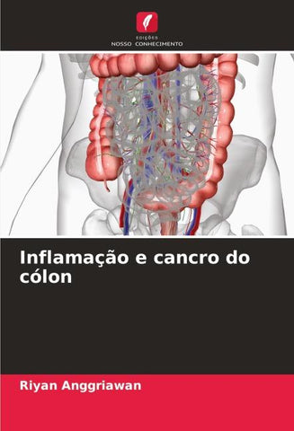Inflamação e cancro do cólon
