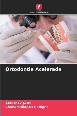 Ortodontia Acelerada