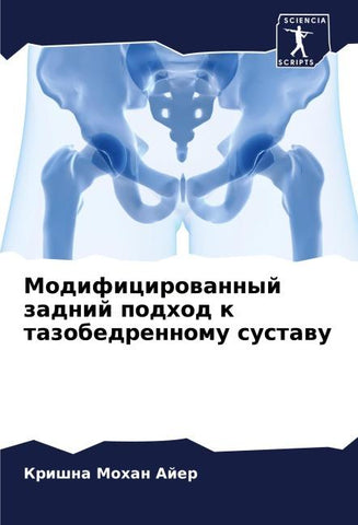 Modificirowannyj zadnij podhod k tazobedrennomu sustawu