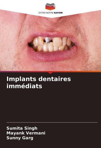 Implants dentaires immédiats