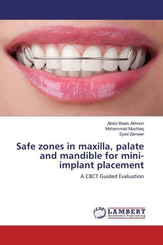 Safe zones in maxilla, palate and mandible for mini-implant placement