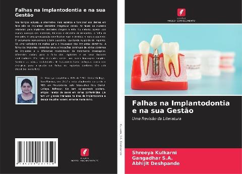 Falhas na Implantodontia e na sua Gestão