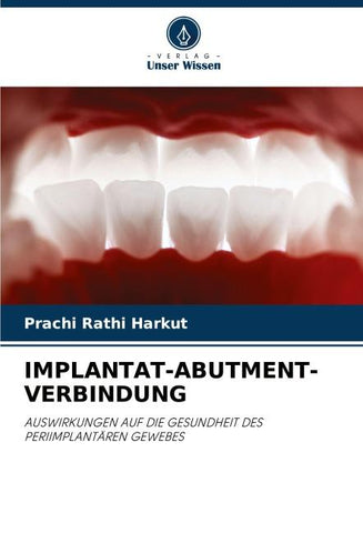 IMPLANTAT-ABUTMENT-VERBINDUNG