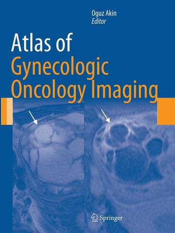 Atlas of Gynecologic Oncology Imaging
