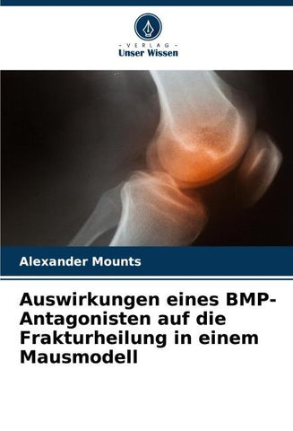 Auswirkungen eines BMP-Antagonisten auf die Frakturheilung in einem Mausmodell