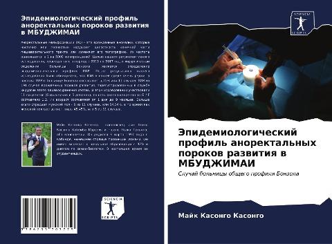 Jepidemiologicheskij profil' anorektal'nyh porokow razwitiq w MBUDZhIMAI