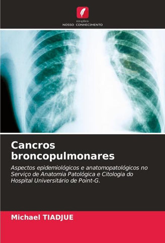 Cancros broncopulmonares