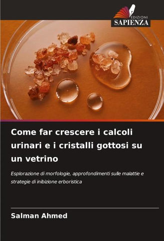 Come far crescere i calcoli urinari e i cristalli gottosi su un vetrino