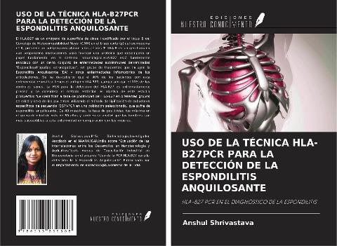 USO DE LA TÉCNICA HLA-B27PCR PARA LA DETECCIÓN DE LA ESPONDILITIS ANQUILOSANTE