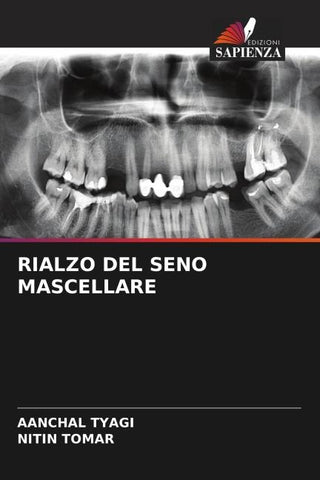 RIALZO DEL SENO MASCELLARE