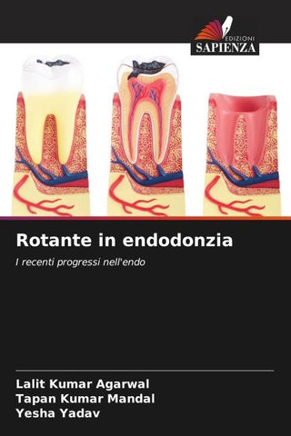 Rotante in endodonzia