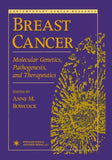 Breast Cancer
