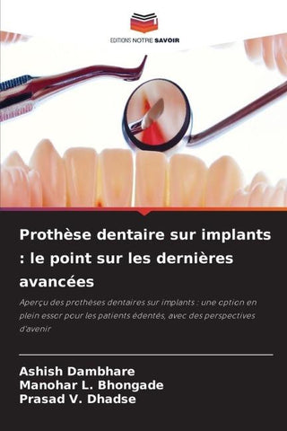Prothèse dentaire sur implants : le point sur les dernières avancées