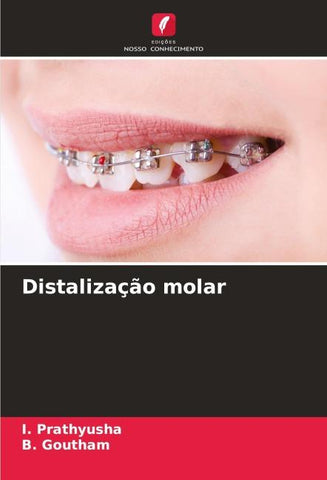Distalização molar