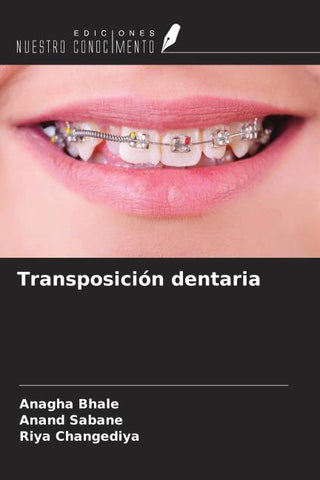 Transposición dentaria