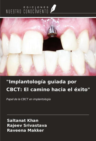 "Implantología guiada por CBCT: El camino hacia el éxito"