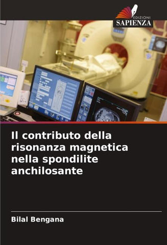 Il contributo della risonanza magnetica nella spondilite anchilosante