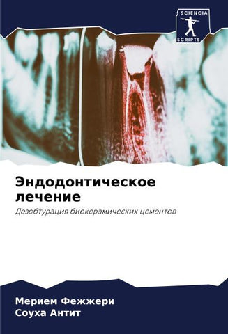 Jendodonticheskoe lechenie