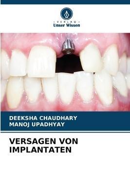 VERSAGEN VON IMPLANTATEN