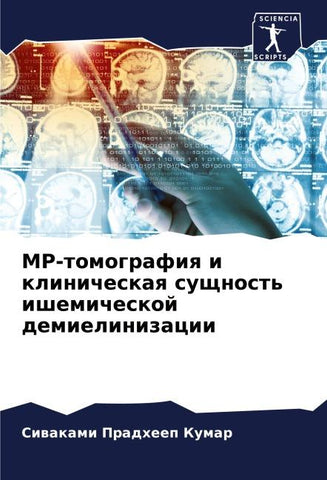 MR-tomografiq i klinicheskaq suschnost' ishemicheskoj demielinizacii