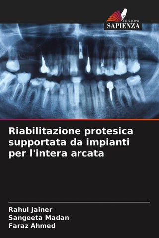 Riabilitazione protesica supportata da impianti per l'intera arcata