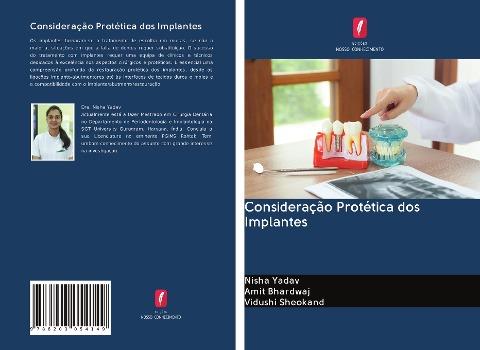 Consideração Protética dos Implantes