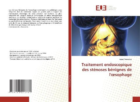 Traitement endoscopique des sténoses bénignes de l'¿sophage